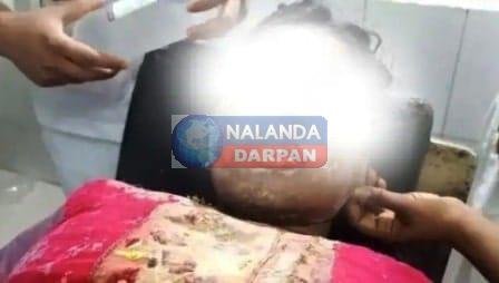 शर्मनाकः डीएम-एसपी आवास के पास राह चलते युवती पर दिनदहाड़े तेजाब फेंका, हालत गंभीर 1 Shameful Acid was thrown at the girl in broad daylight while walking near DM SP residence condition critical 3