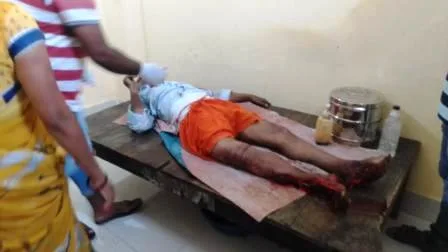 इसलामपुरः जेसीबी के चपेट में आने से बीच बाजार डीलर की मौत 1 Islampur Dealer injured after being hit by JCB condition critical 1