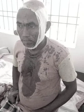 पॉल्ट्रीफार्म को बंद करने के प्रतिशोध में मारपीट, महिला समेत पांच जख्मी 1 Fighting in retaliation for closure of poultry farm five injured including woman 2