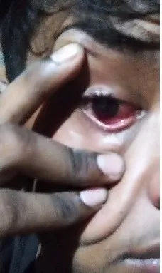 देखिए बदमाशों ने इस निरीह बालक का पीट-पीटकर क्या हाल बना डाला! 2 See what condition the miscreants created by beating this innocent child