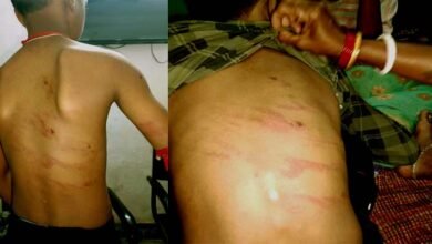 इस प्राइवेट स्कूल का प्रिंसिपल बना हैवान, पांचवीं कक्षा के छात्र पर ढाया कहर 3 Private school principal turns monster wreaks havoc on fifth grade student