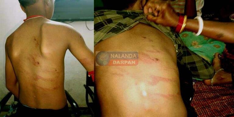 इस प्राइवेट स्कूल का प्रिंसिपल बना हैवान, पांचवीं कक्षा के छात्र पर ढाया कहर इस प्राइवेट स्कूल का प्रिंसिपल बना हैवान, पांचवीं कक्षा के छात्र पर ढाया कहर